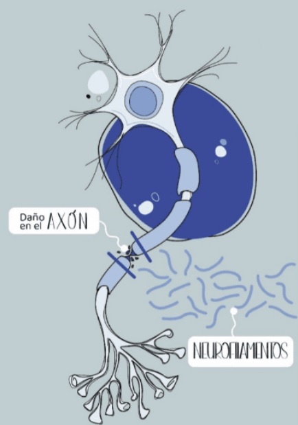 neurofilamentos